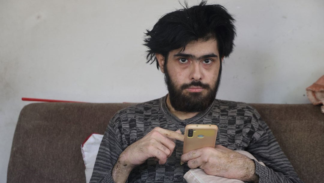 3 yıldır evden dışarı adım atmadı: “Banyo da yapmak istemiyorum, elimde olsa tuvalete gitmem”