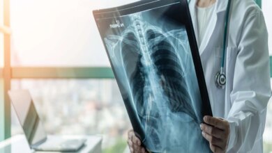 Prof. Dr. Şener’den süperenfeksiyon uyarısı