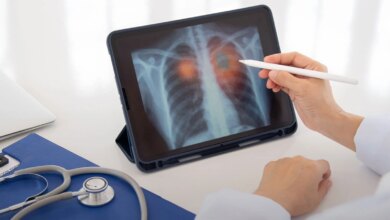 Dünya Sağlık Örgütü’ne Göre Akciğer Kanseri Tehlikesi