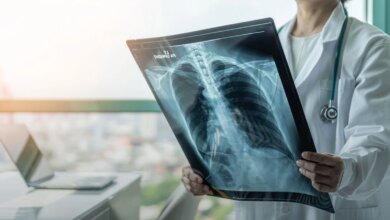 Kronik Tromboembolik Pulmoner Hipertansiyon Hakkında