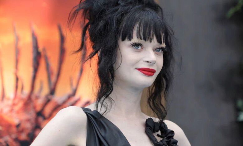 Ünlü oyuncu Ruth Codd’un ikinci ayağı ampute edildi