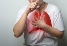 Zatürre, Kanser Belirtisi Olabilir Uyarısı Yapıldı